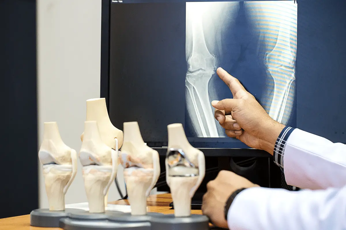 5-sinais-consultar-medico-ortopedista